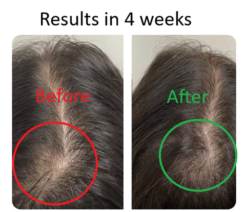 2 ALLOPANIL Hair Growth Oil